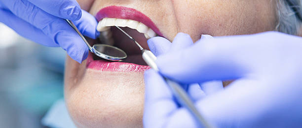 Best Chipped Tooth Repair Near Me  in Grantsville, UT